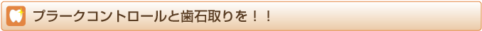 プラークコントロールと歯石取りを！！