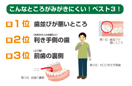 こんなところがみがきにくい!ベスト3!