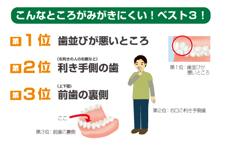 こんなところがみがきにくい！ベスト３！