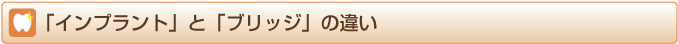 「インプラント」と「ブリッジ」の違い